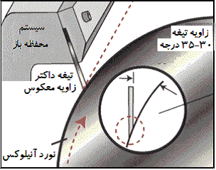 سیلندر آنیلوکس